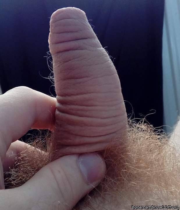 My Foreskin And The Hairs Growing From It.
