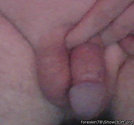 Adult image from foreskin78