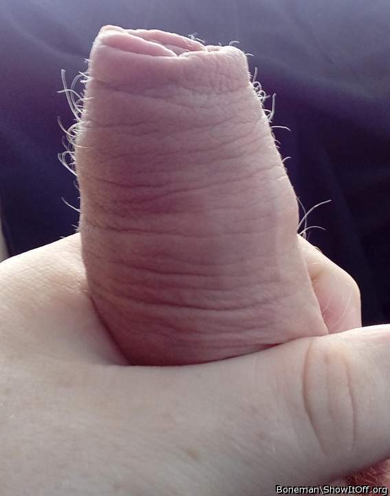 Foreskin with hairs growing up the sides