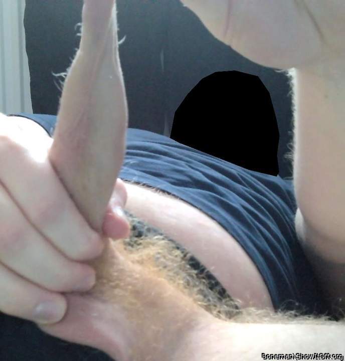 foreskin with hair