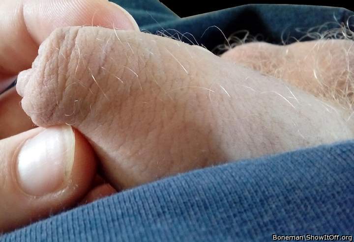 Close Up Of My Hairy Foreskin