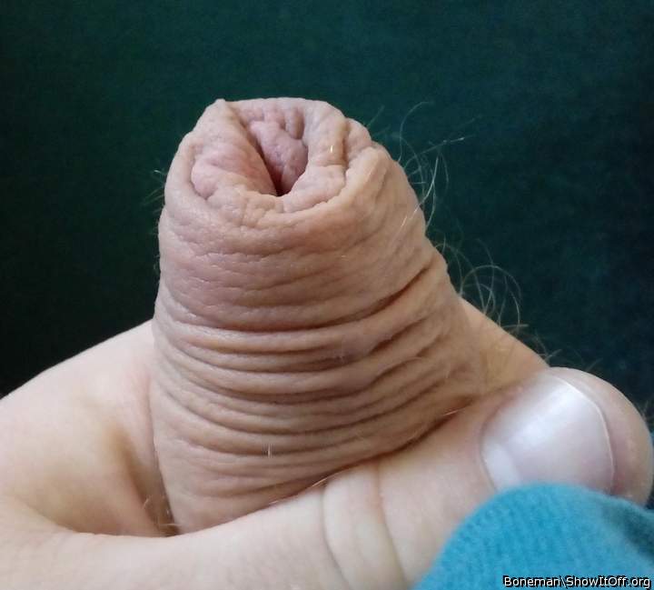 Natural Foreskin With Hairs Growing From It
