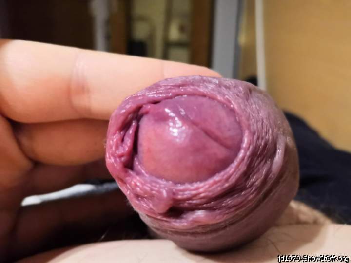 glans and foreskin close-up