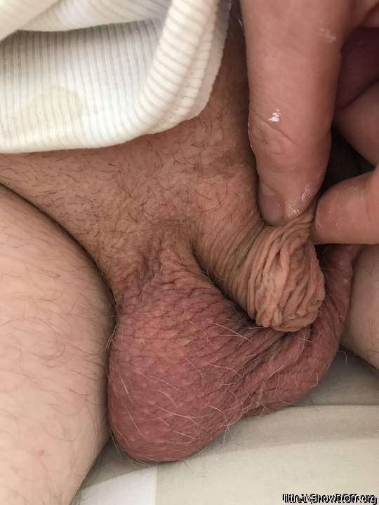 tiny penis