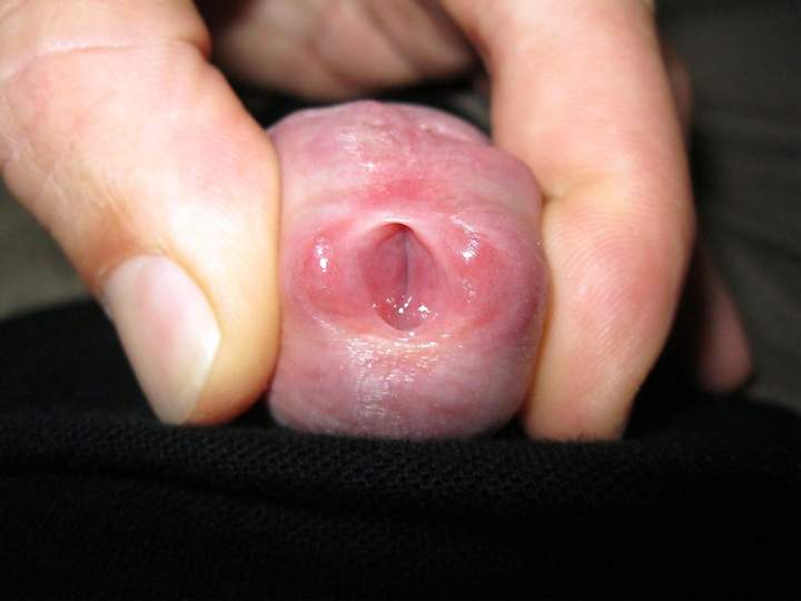 pee- or sperm-hole