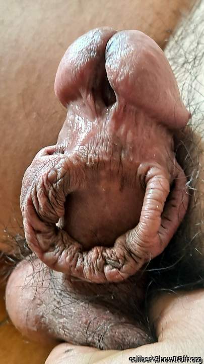 before foreskin removal