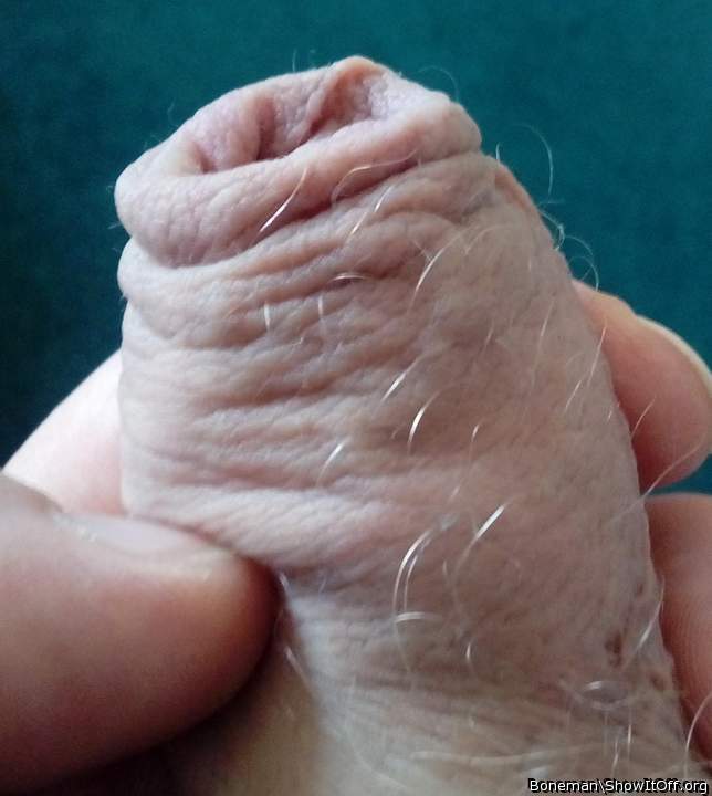 Light Hairs Growing From Foreskin
