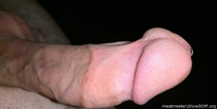 such a beautiful tight circumcision; hot looking scar too