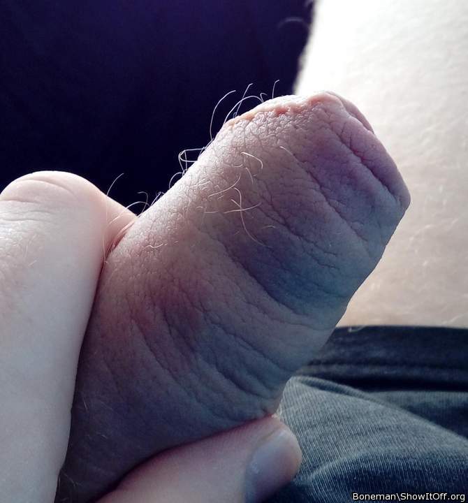 My Foreskin Is Hairy