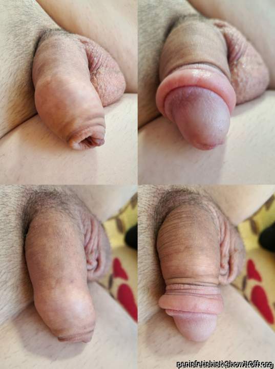 how the foreskin looks on a flaccid penis after using a penis pump