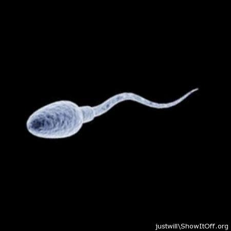 This is a SPERM cell
