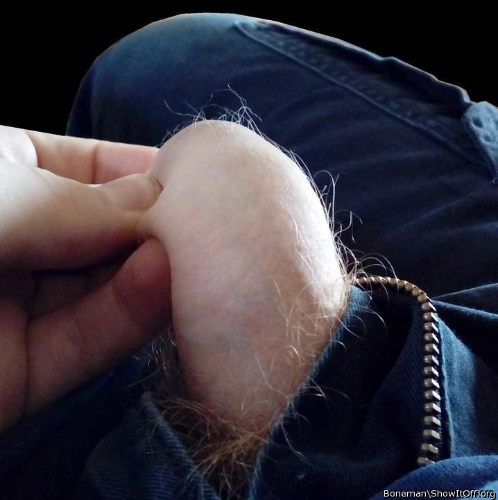 A Hairy Foreskin