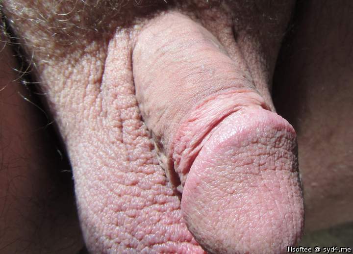 I love how the glans dries out when the foreskin is removed 