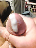 Photo of a penile from Dan76