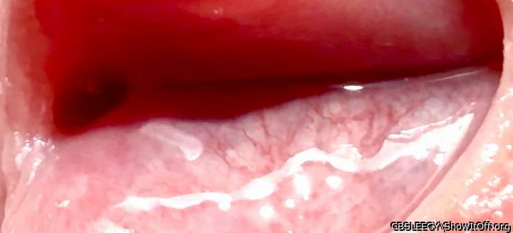 Vein definition inside the uretha!