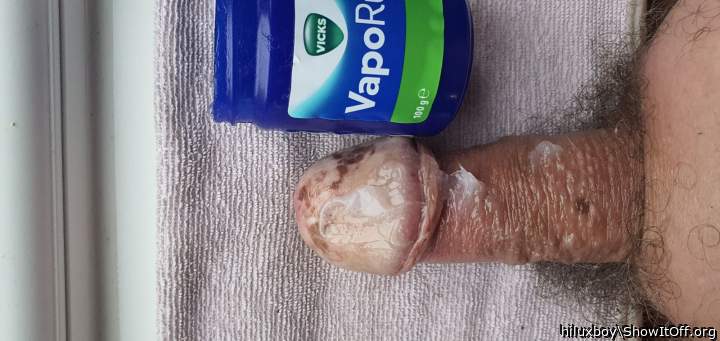 Adult image from hiluxboy