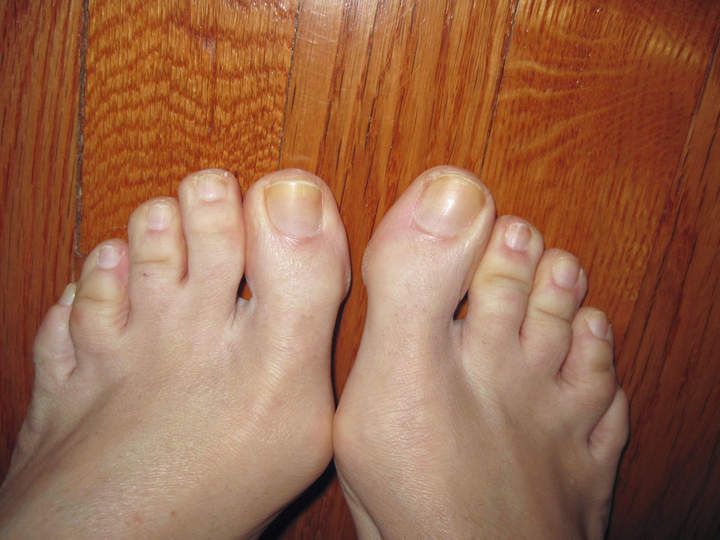 Toes....