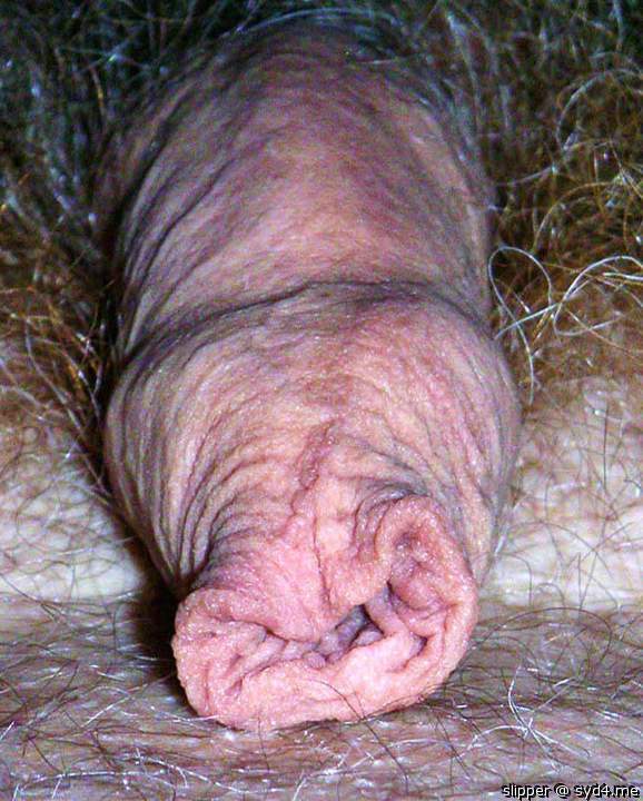 The foreskin of the foreskins. Fantastic!