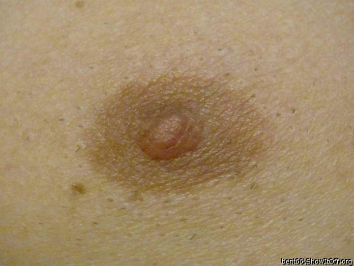 left nipple