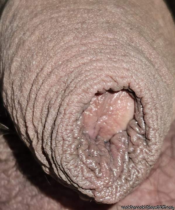 Foreskin wrinkles