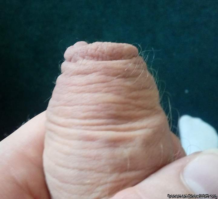 The Tip Of My Hairy Foreskin