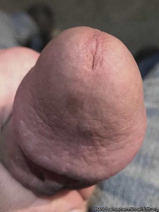 My penis head. Note the birthmark