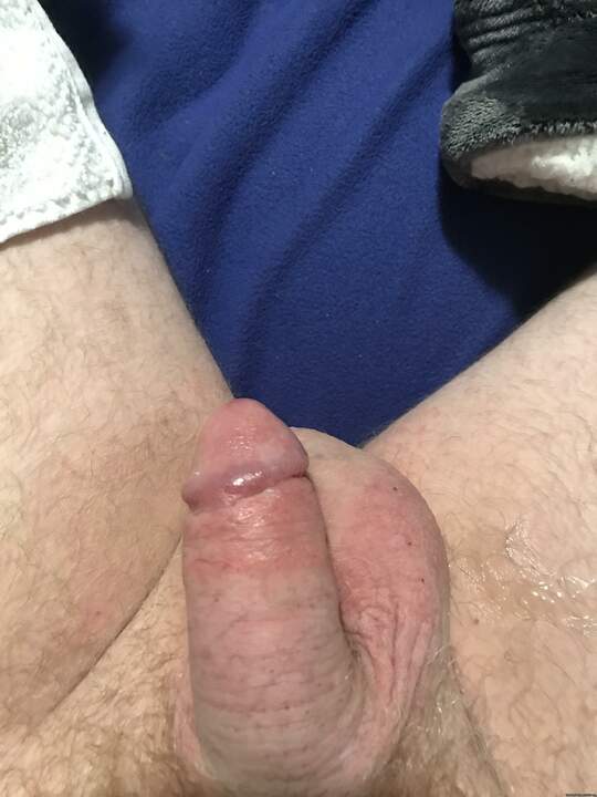 First post