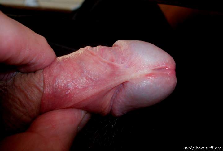 Flaccid penis with frenulum and retracted foreskin