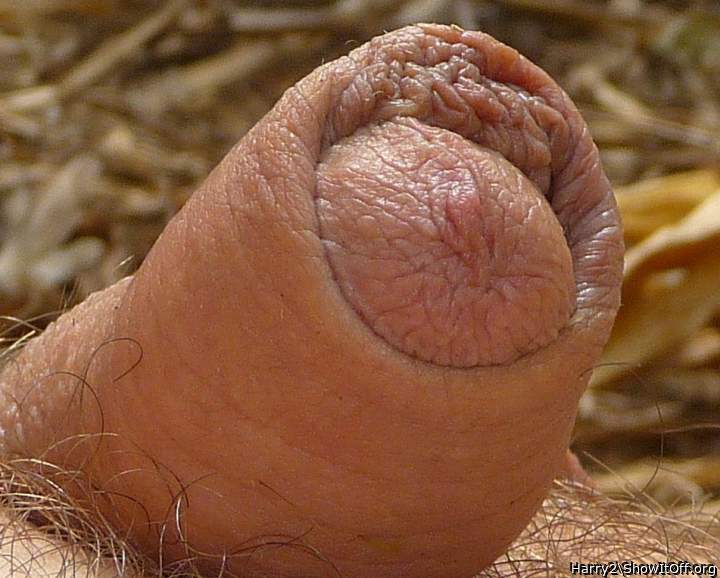 Beautiful foreskin