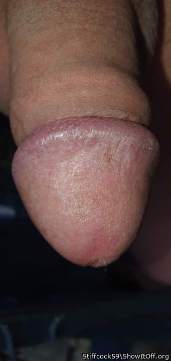 My dick is throbbing! It looks circumcised with the foreskin