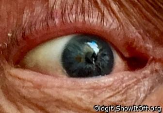 Eye eye nearly 80 year old eye