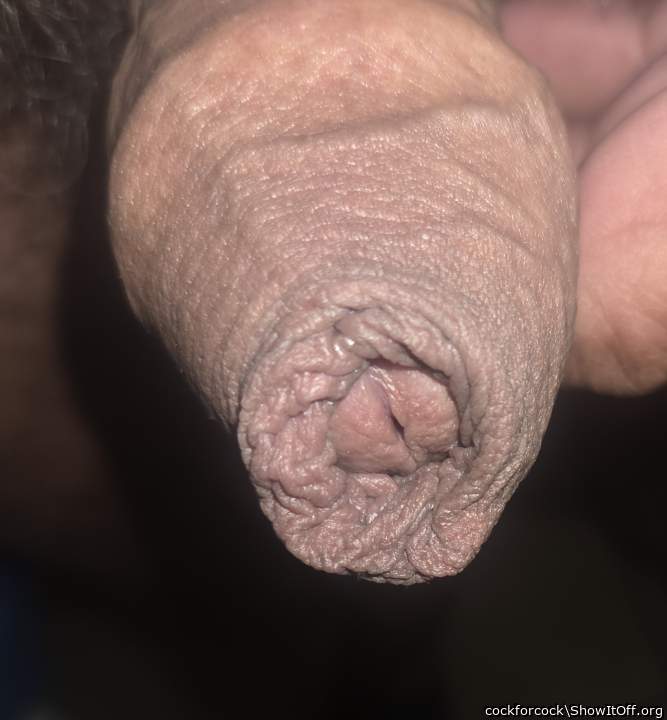 Foreskin galore