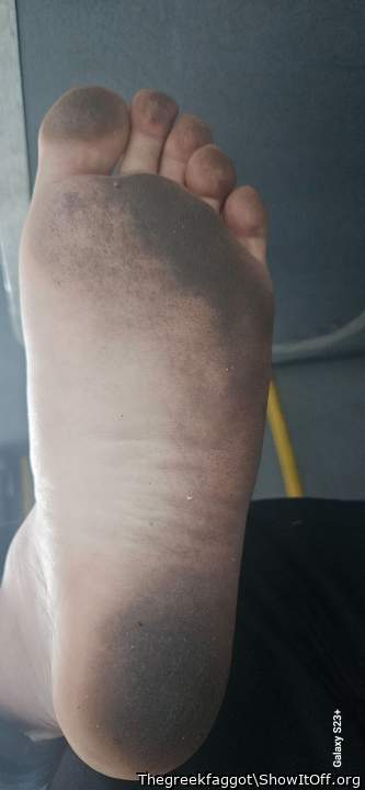Dirty feet