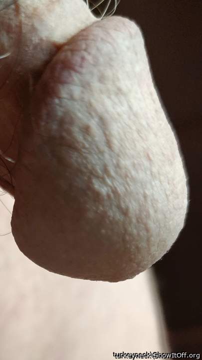 Adult image from turkeyneck