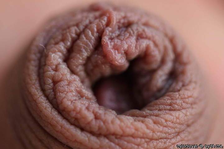 Foreskin