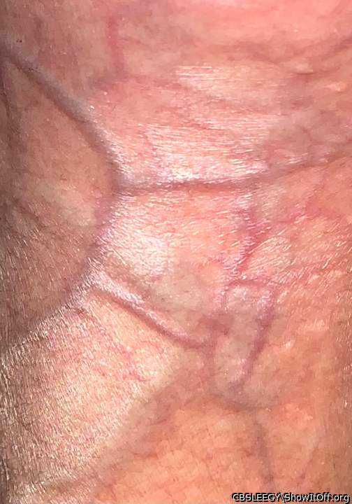 Square Veins?