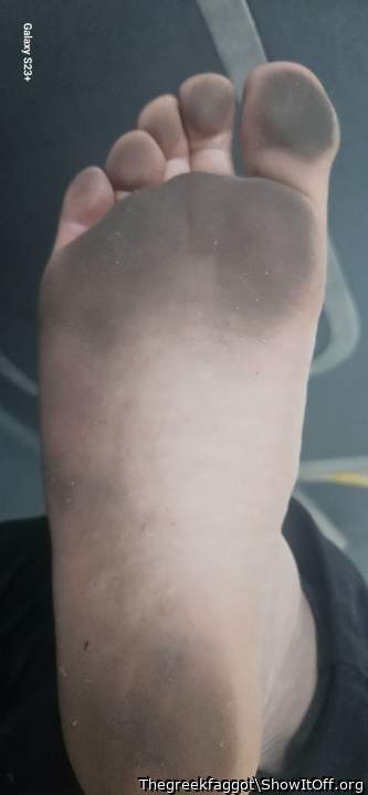 Dirty feet