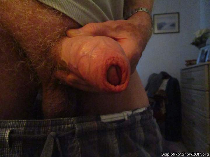 Fantastic foreskin