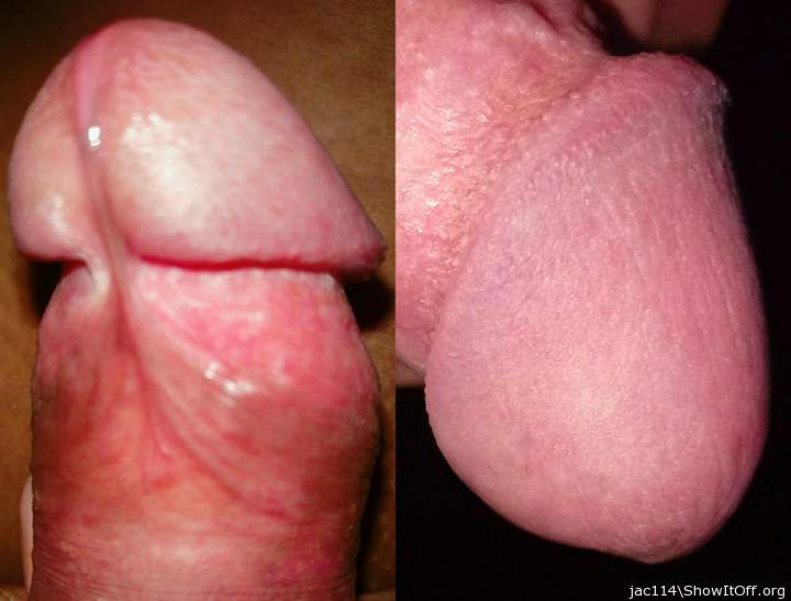 Front or back?
