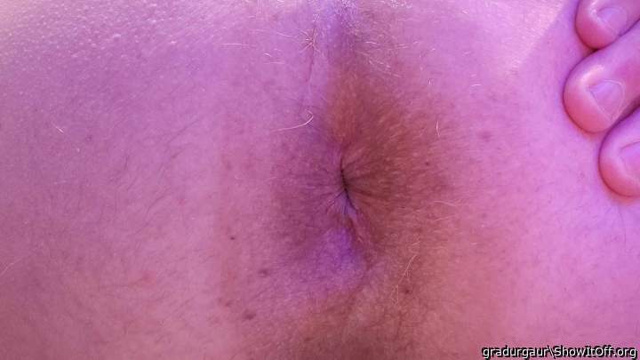 My butt hole