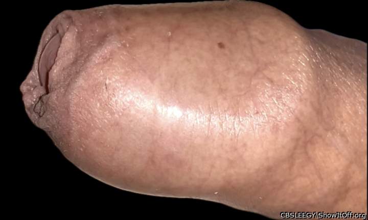 Shaped head inside foreskin!