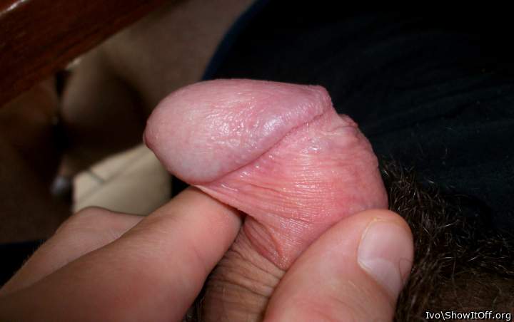 Glans sideview with corona, frenulum and retracted foreskin