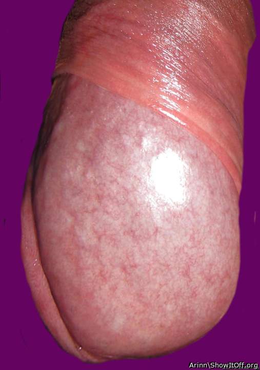 Adult image from Arinn