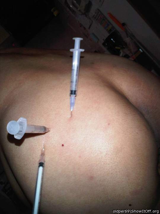 needle play