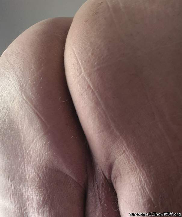 This ass needs some attention, what attention will you provide.?