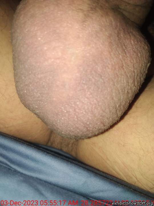 Adult image from exhibit