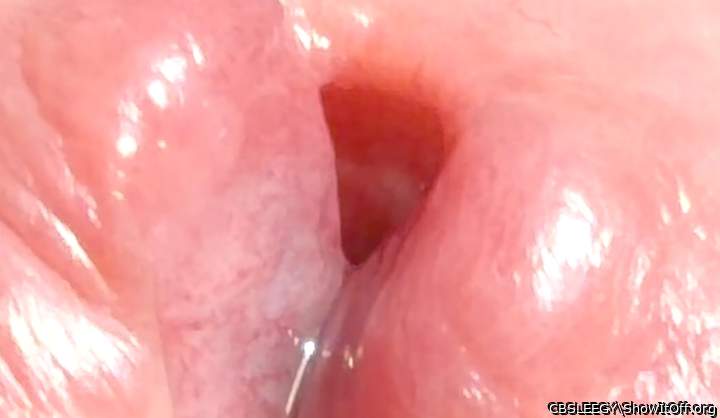 Freckles near the cumhole!?