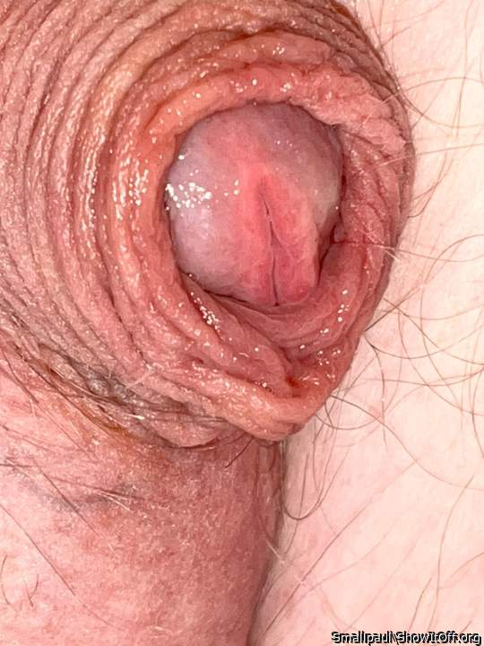 Love the precum in the foreskin.