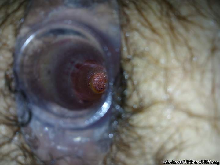 HallowAnal_photo3of3angle