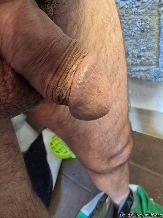 your foreskin really looks natural behind the glans like tha